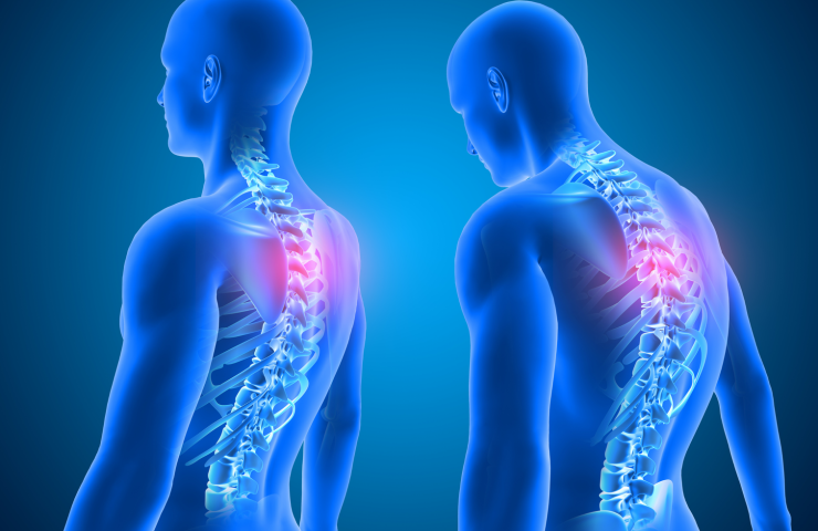 bad_posture_1512x_49fa2c2a-12bf-4941-9587-8be68c64ca5f